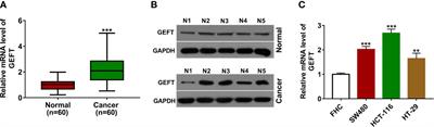 Long Non-Coding RNA LINC00355 Promotes the Development and Progression of Colorectal Cancer by Elevating Guanine Nucleotide Exchange Factor T Expression via RNA Binding Protein lin-28 Homolog A